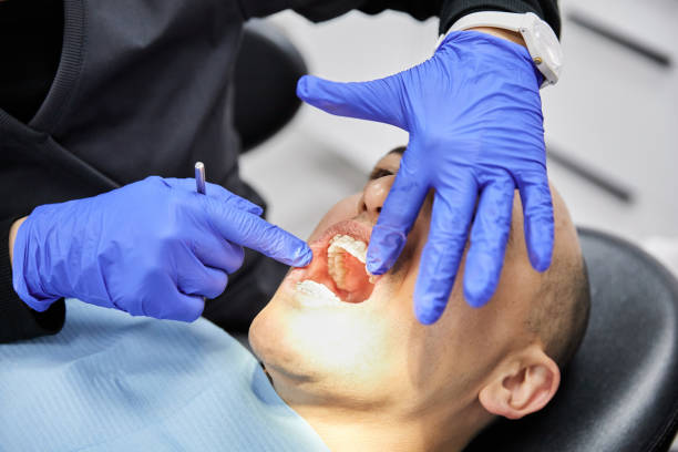 Best Emergency Treatment for Oral Infections in Shinnecock Hills, NY