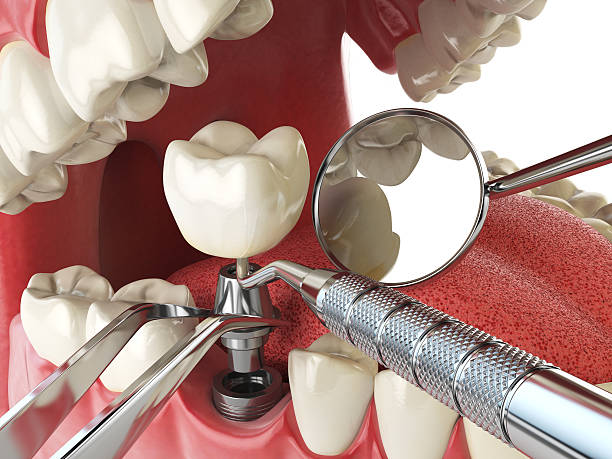 Best Emergency Denture Repair in Shinnecock Hills, NY